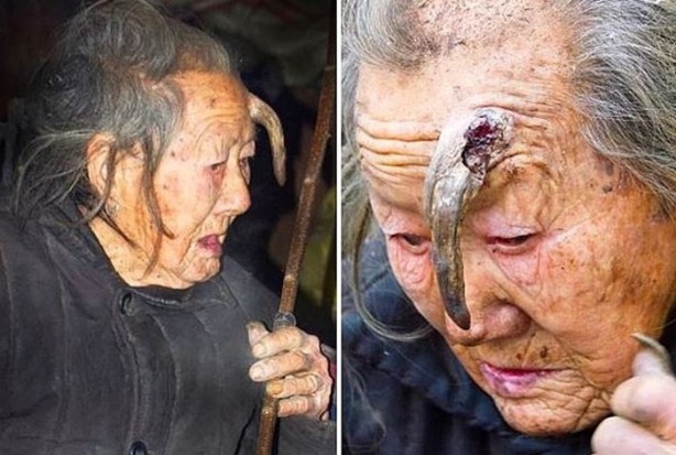 Foto - Dünyanın en garip insanları