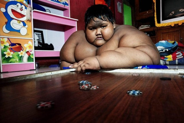 Foto - Dünyanın en şişman çocuğu 31 kilo verdi!