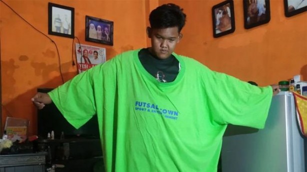 Foto - Dünyanın en şişman çocuğuydu! 110 kilo verdi