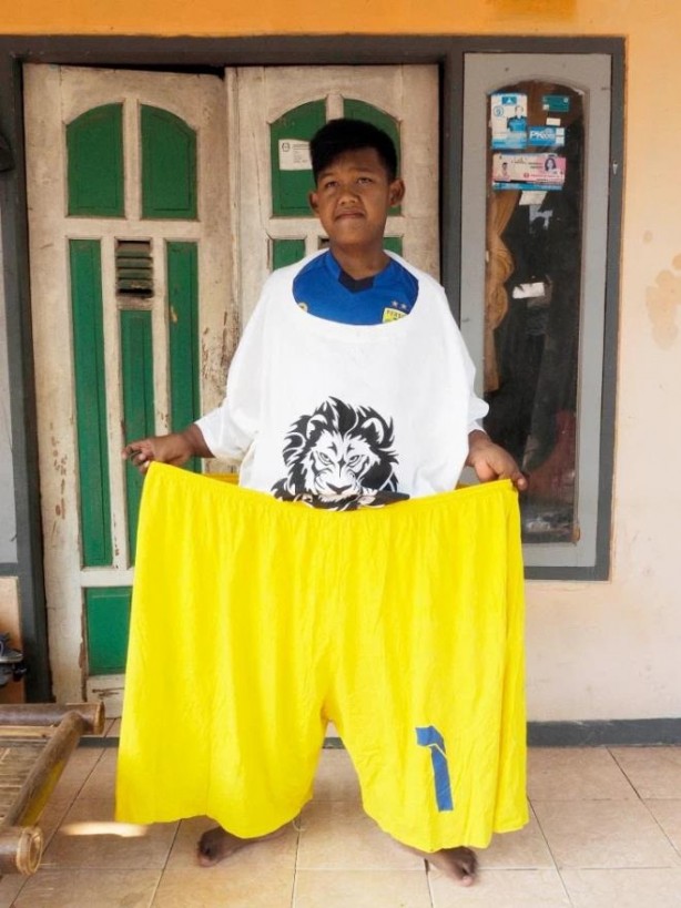 Foto - Dünyanın en şişman çocuğuydu! 110 kilo verdi