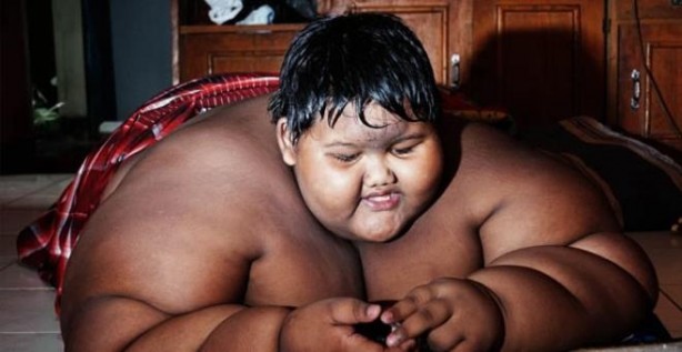 Dünyanın en şişman çocuğuydu! 110 kilo verdi