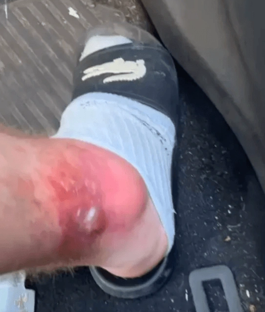 Foto - Dünyanın en tehlikelerinden biri! Yanından bile geçtiğine pişman oldu