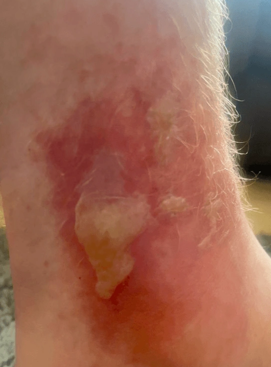 Foto - Dünyanın en tehlikelerinden biri! Yanından bile geçtiğine pişman oldu