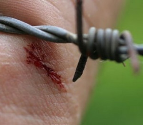 Foto - Dünyanın en tehlikeli 12 hastalığı