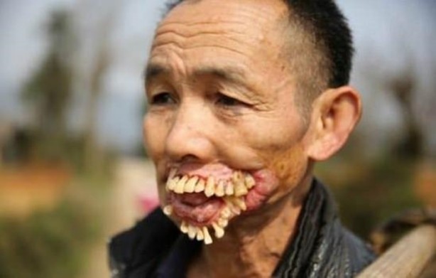 Foto - Dünyanın en tuhaf hastalıkları