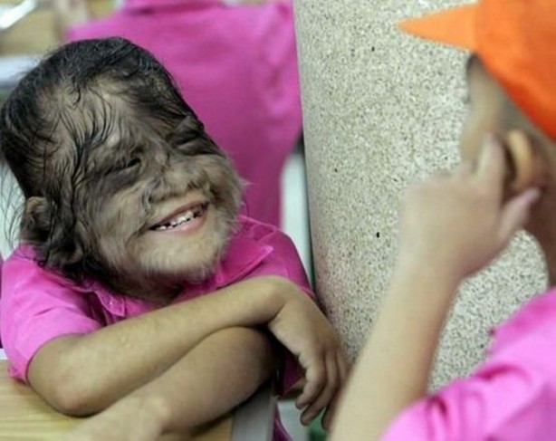 Dünyanın en tuhaf hastalıkları