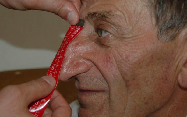 "Dünyanın en uzun burunlu adamı" seçilen Artvinli öldü, son görüntüleri Togg'la