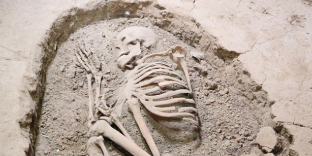 Dünyanın ilk beyin ameliyatı 10 bin 500 yıl önce Aksaray’da yapıldı