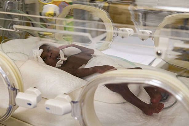 Foto - Dünyanın tek dokuzları: Herkes bebekleri görmek için akın ediyor