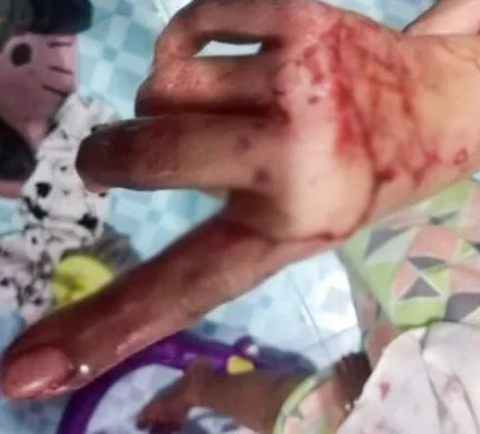 Foto - Dünyayı şaşkına çeviren olay! Tuvaleti kullandığı sırada 2 metrelik yılan…