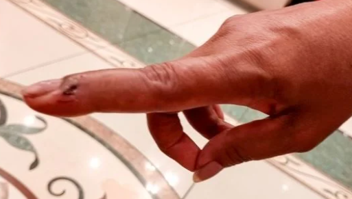 Foto - Dünyayı şaşkına çeviren olay! Tuvaleti kullandığı sırada 2 metrelik yılan…