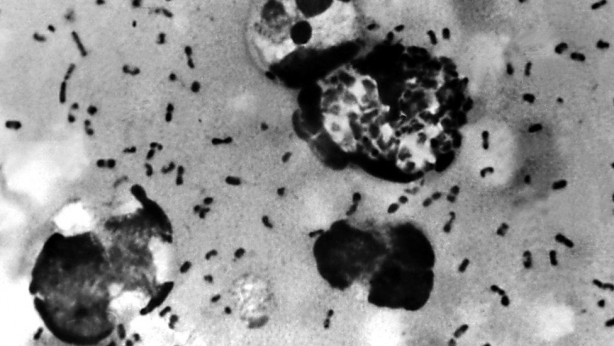 Foto - Dünyayı yok olma eşiğine getiren felaket