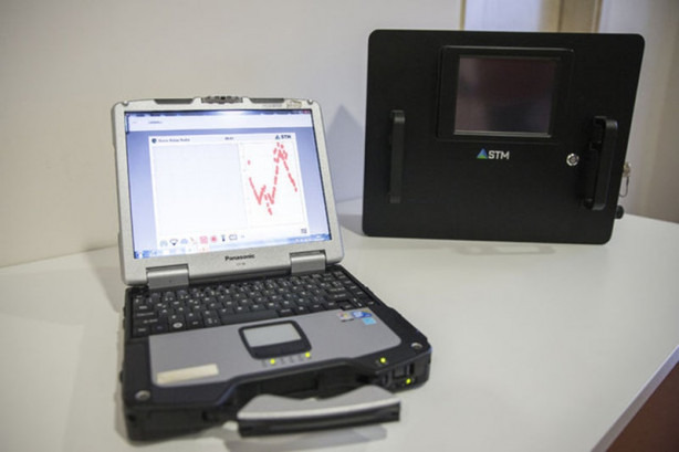 Foto - Duvarın arkasını görüyor! Yüzde 100 yerli