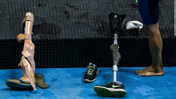 Foto - Duyguları aktarabilen elektronik deri