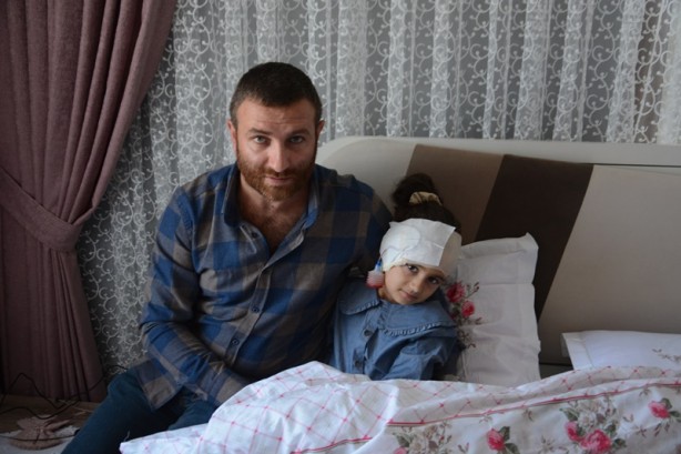 Foto - Düzce'de pitbull saldırısı! Çocuğun başına 300 dikiş atıldı