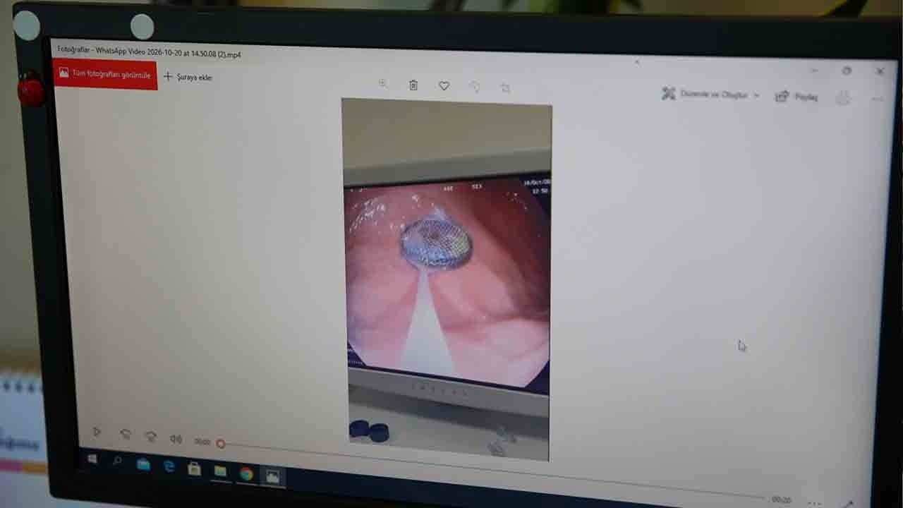 Foto - Ebeveynlerin kulaklarına küpe olsun: 0-5 yaş çocuğu olanlar dikkat!
