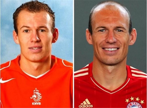 Foto - Efsane futbolcuların değişimleri şaşırtıyor!