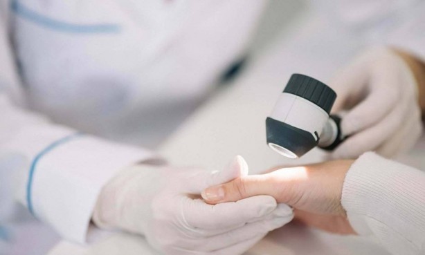 Foto - Eğer 1 haftayı geçerse… Saçlarında bu sorunu olanları ilgilendiren haber