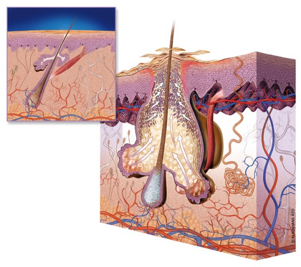 Foto - Eğer çıkan sivilce yüzünüzün bu bölgesindeyse aman dikkat! Hangi bölgede çıkıyorsa o hastalığın habercisi