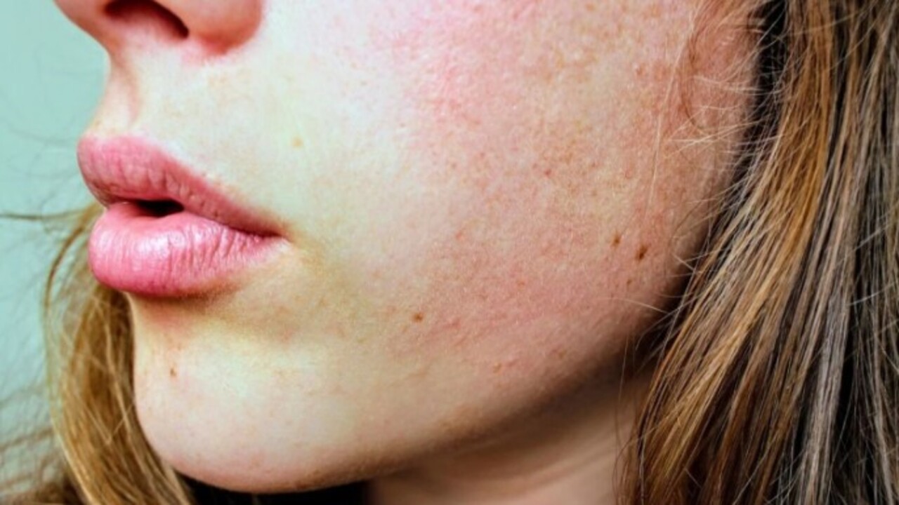 Foto - Egzaması olanların dikkatine! Bu 7 faktör tetikliyor olabilir