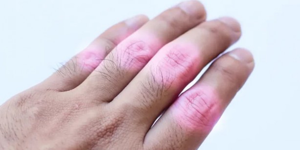 Foto - Eklem ağrılarından kurtaran en doğal tarif: Limon kabuğu ile bir kaç defa daha yapıldı, sonucu şoke etti! 