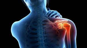 Foto - Eklem ve kemik ağrılarını bıçak gibi kesen doğal yöntem