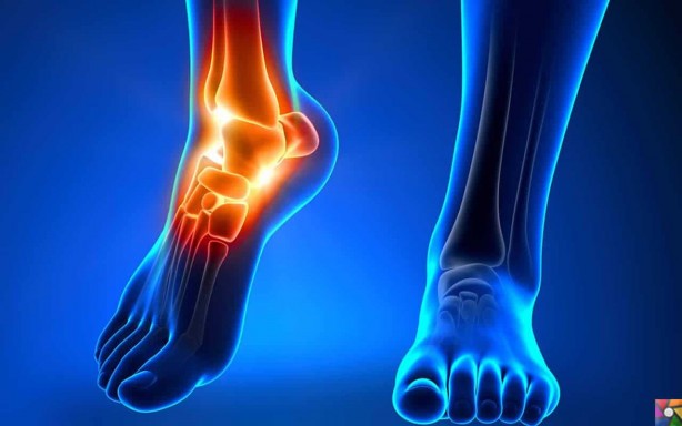 Foto - Eklem ve kemik ağrılarını bıçak gibi kesen doğal yöntem