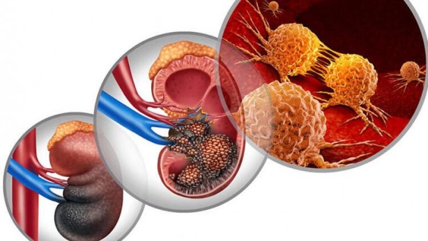 Foto - Eksikliği beyni yaşlandırıyor! Uzman isim uyardı