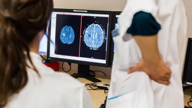 Foto - Eksikliği beyni yaşlandırıyor! Uzman isim uyardı