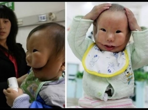 Foto - Ekstra organları olan insanlar