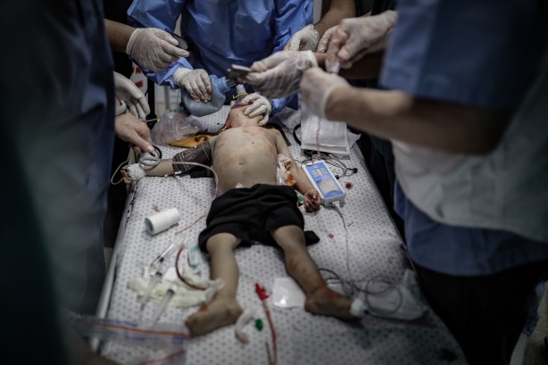 Foto - Elin değil, soyun kurusun Siyonist İsrail! Bu acıya yürek dayanmaz... 