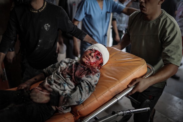 Foto - Elin değil, soyun kurusun Siyonist İsrail! Bu acıya yürek dayanmaz... 