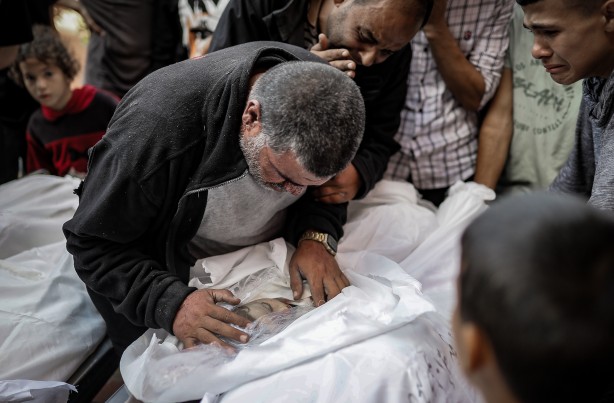 Foto - Elin değil, soyun kurusun Siyonist İsrail! Bu acıya yürek dayanmaz... 