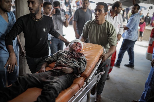 Foto - Elin değil, soyun kurusun Siyonist İsrail! Bu acıya yürek dayanmaz... 