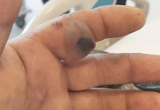 Foto - Elinde poşetle hastaneye koştu! Poşetten çıkana kimse inanamadı
