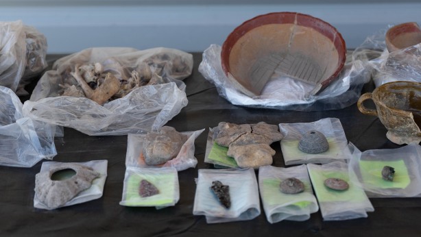 Foto - Elinde tuttuğu insan kemiği! Onlarcası bulundu