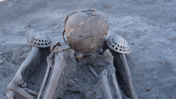 Foto - Elinde tuttuğu insan kemiği! Onlarcası bulundu