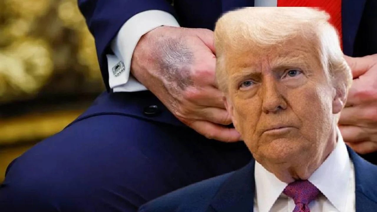 Elleri mosmor oldu... Trump ölüyor mu?