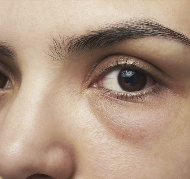 Foto - Elma ile İnanılması Güç Tedavi Yöntemleri!