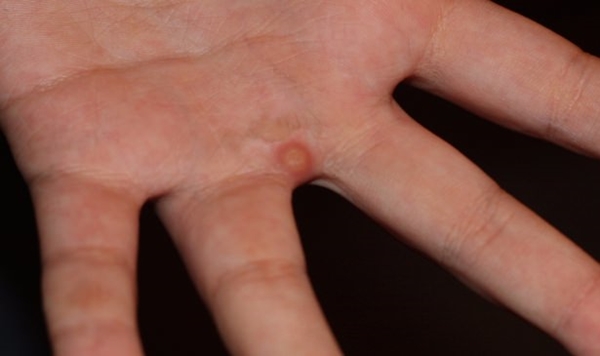 Foto - Elma sirkesinin hiç bilmediğiniz kullanım alanları