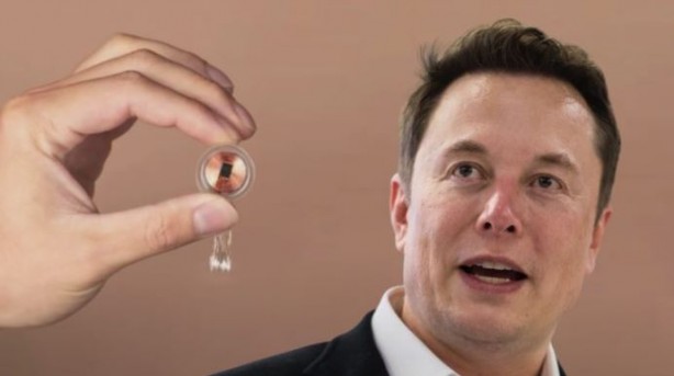 Foto - Elon Musk sonunda bunu da yaptı! İlk defa bir insan beynine çip taktılar