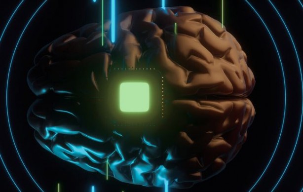 Foto - Elon Musk sonunda bunu da yaptı! İlk defa bir insan beynine çip taktılar