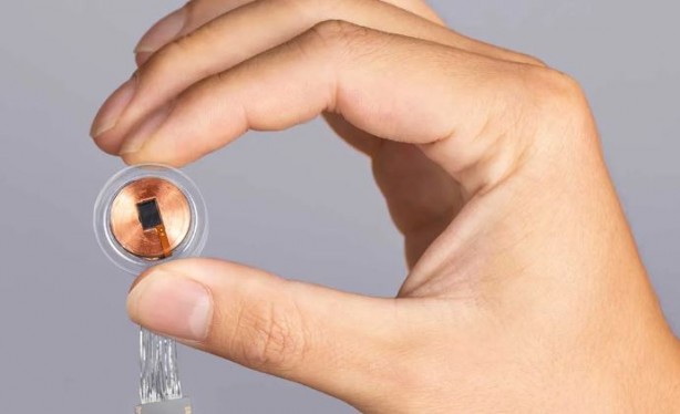 Foto - Elon Musk sonunda bunu da yaptı! İlk defa bir insan beynine çip taktılar