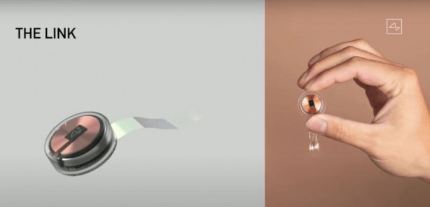 Foto - Elon Musk sonunda bunu da yaptı! İlk defa bir insan beynine çip taktılar