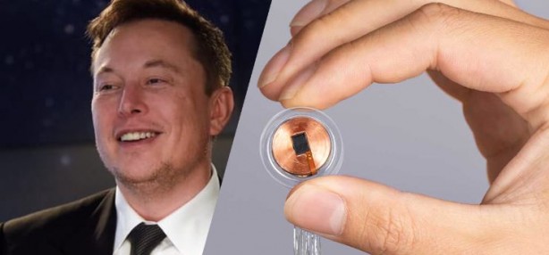 Foto - Elon Musk sonunda bunu da yaptı! İlk defa bir insan beynine çip taktılar
