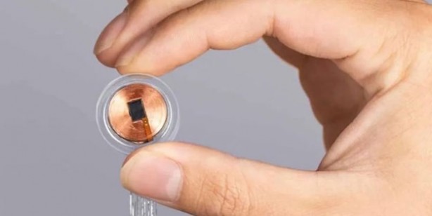 Foto - Elon Musk’ın başı beladan kurtulmuyor! Neuralink'e hayvan hakları nedeniyle dava açıldı