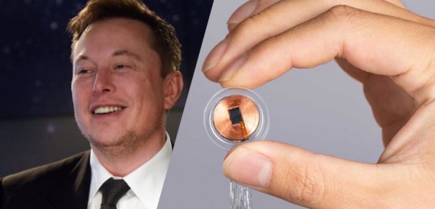 Foto - Elon Musk’ın beyin çipi şirketi Neuralink'e para cezası