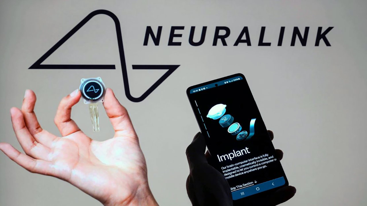 Foto - Elon Musk'ın Neuralink şirketi bir hastaya daha çip taktı