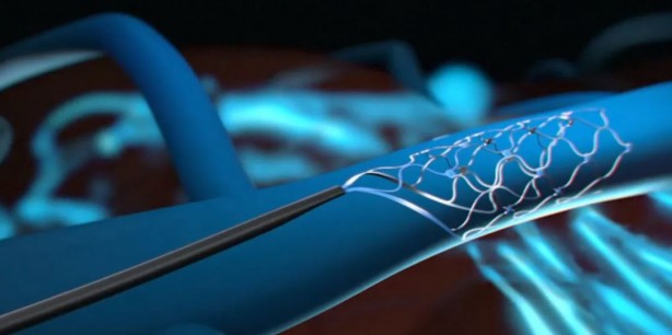 Foto - Elon Musk'ın rakibi başardı! Synchron, düşünce ile Apple Vision Pro kullanmayı başardı