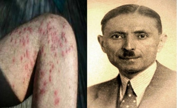 Foto - En çok bilinen hastalıkların şaşırtan hikayeleri… Kanseri kimse böyle beklemiyordu